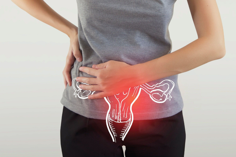 PCOS specialist consultation